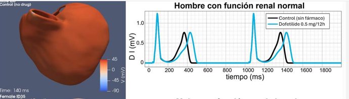 La UPV desarrolla una metodología de simulación computacional para identificar la dosis de medicamentos óptima para prevenir arritmias