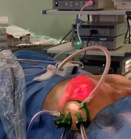 El Hospital del Vinalopó implanta la mastectomía endoscópica, una técnica "pionera" para tratar cáncer de mama