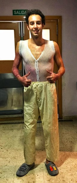 Álvaro Trigo, uno de los pacientes a quienes se implantó la piel artificial diseñada por la Universidad de Granada.