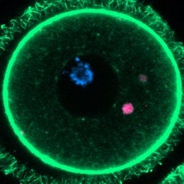 ELVAs (magenta) fotografiados dentro de un ovocito de ratón utilizando tintes fluorescentes.