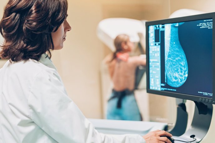 Archivo - Imagen de archivo de una mamografía.