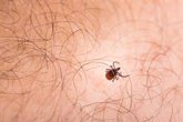 Foto: La proliferación de garrapatas por el cambio climático puede multiplicar los casos de Lyme, según un estudio