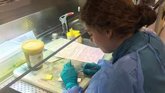 Foto: Investigan establecer un marcador en sangre y nuevos tratamientos para los nevus melanocíticos congénitos gigantes