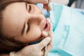 Foto: Selladores dentales contra las caries, ¿es efectivo el fluoruro de diamina de plata?