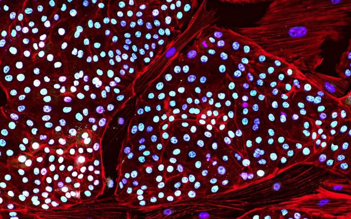 Colonias de iPSC de elefante asiático teñidas para detectar factores de pluripotencia OCT4 (magenta) y SOX2 (verde), ADN nuclear Hoechst (azul) y proteína actina citoesquelética (rojo),