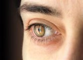 Foto: La detección precoz evitaría la ceguera total en el 90% de los casos de glaucoma