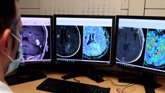 Foto: Una nueva herramienta de IA mejorará el diagnóstico diferencial de tumores cerebrales