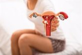Foto: La detección precoz es clave para tratar la endometriosis, una enfermedad crónica que afecta al 10% de las mujeres