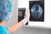 Foto: La resonancia magnética mamaria, imprescindible para evitar tratamientos innecesarios