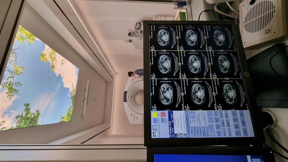 Imagen estudio oncología