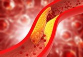 Foto: La lipoproteína (a), un tipo de colesterol que se hereda, aumenta el riesgo cardiovascular, según experta