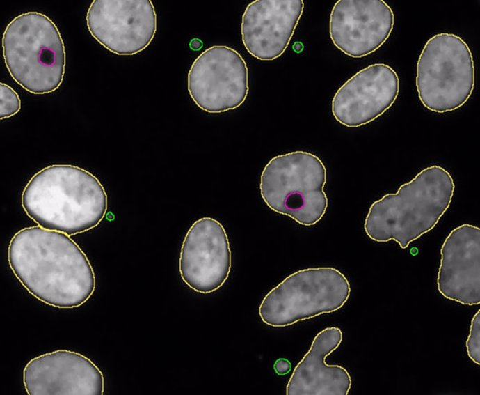 Núcleos toroidales marcados en magenta y micronúcleos en verde.