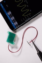Foto: Un nuevo dispositivo permite a los pacientes controlar la función de la vejiga