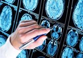Foto: Buena noticia para el riesgo de demencia: los cerebros humanos son cada vez más grandes