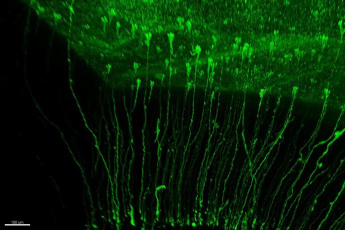 Diversidad de células Glia Radial en la corteza cerebral de hurón neonato, marcadas con proteína fluorescente verde y vistas dentro del cerebro transparentado.