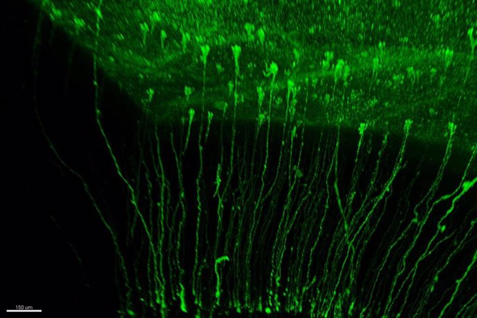 Diversidad de células Glia Radial en la corteza cerebral de hurón neonato, marcadas con proteína fluorescente verde y vistas dentro del cerebro transparentado.