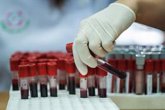 Foto: Las nuevas terapias logran hasta un 70% de sangrado cero en los pacientes con hemofilia
