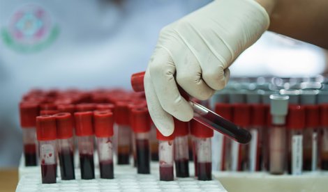 Investigación