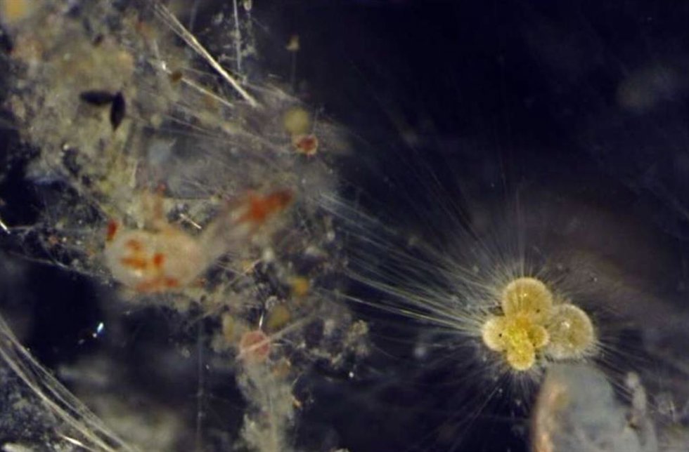 Plankton Foriminifera.