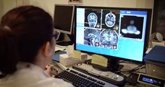 Foto: Detectan con un análisis de sangre un mecanismo clave en el desarrollo del Alzheimer en humanos