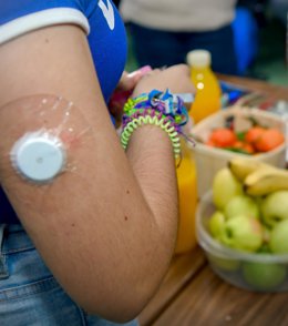 Archivo - Paciente con un dispositivo MFG de control de la diabetes.