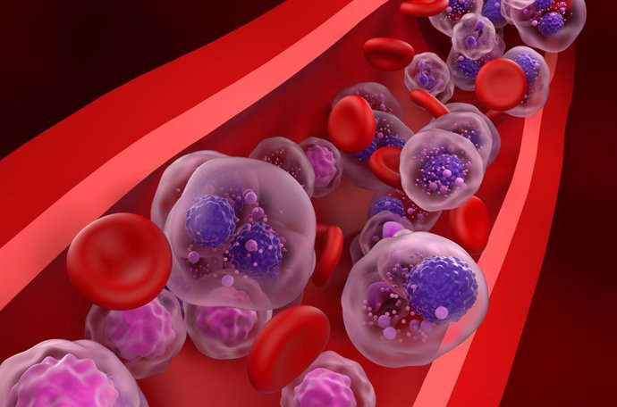 Archivo - Imagen de las células de mieloma múltiple agrupándose en el flujo sanguíneo.