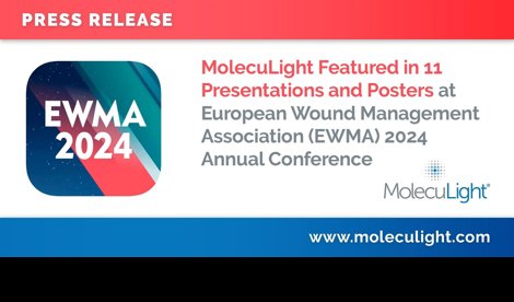 Comunicados Internacional