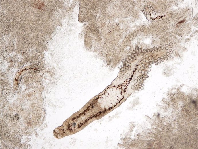 Imagen ampliada del parásito  ‘Sparicotyle chrysophrii’