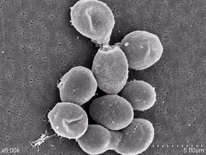 Foto al microscopio electrónico de la levadura Saccharomyces cerevisiae durante el proceso de envejecimiento del cava.