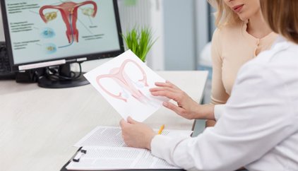 La SEGO recuerda la importancia de reconocer los síntomas del cáncer de ovario para facilitar el diagnóstico precoz