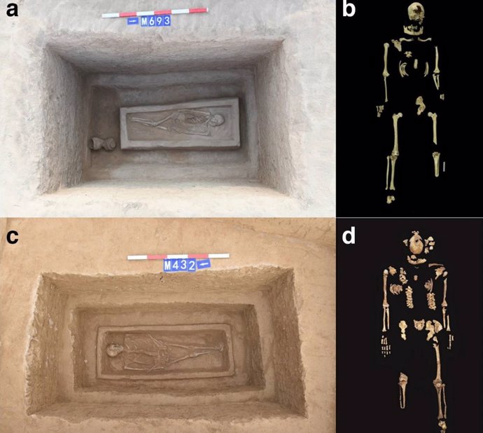 Las tumbas y esqueletos del hombre con la amputación de la pierna izquierda, designado M693 (a-b), y el hombre con la amputación de la pierna derecha, designado M432 (c-d).
