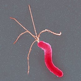 Archivo - Imagen del 'Helicobacter pylori'.