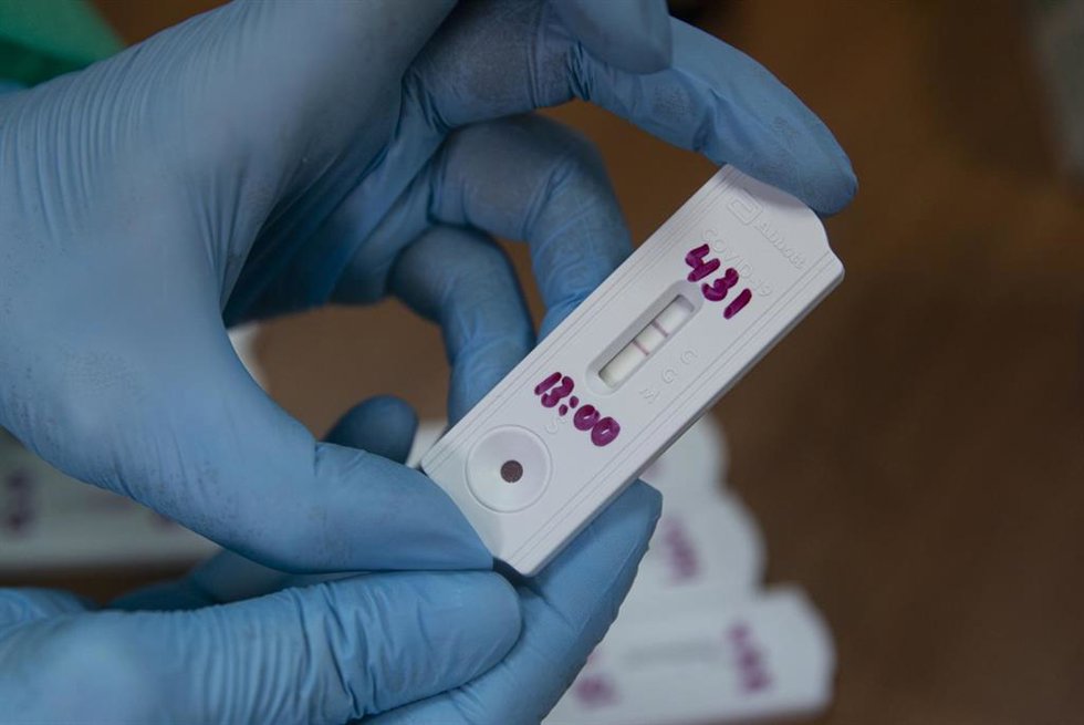 Archivo - Comienzo de los test de cribado de la Covid-19 al personal docente en la educación antes del retorno a la actividad laboral. En la imagen, un test rápido de resultado positivo utilizado en dicha prueba. En las instalaciones del Hospital Milita