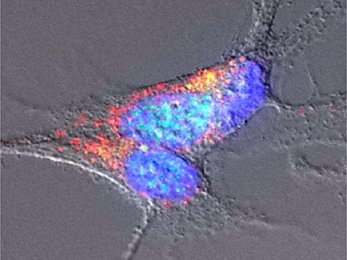 Archivo - Investigadores españoles encuentran en la microbiota intestinal amiloides asociados con la enfermedad de Parkinson