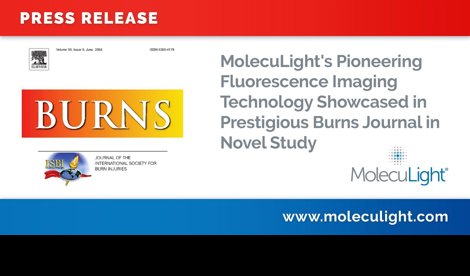 Comunicados Internacional