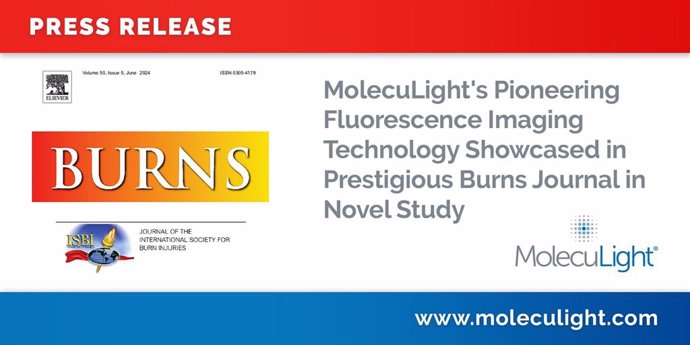 MolecuLight's Pioneering Fluorescence Imaging Technology Showcased in Prestigious Burns Journal in Novel Study