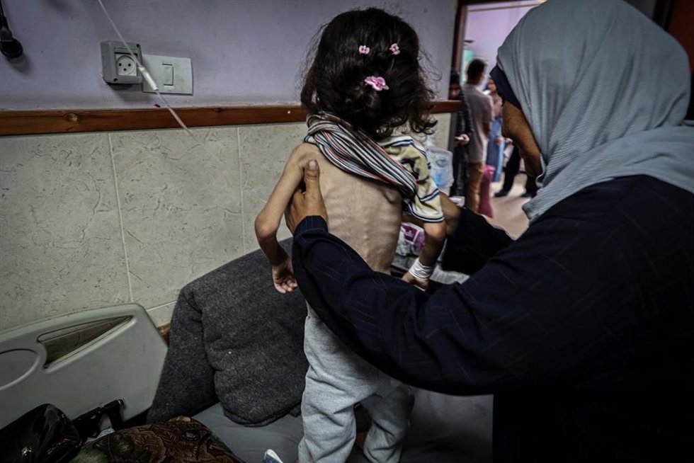 Una niña palestina con desnutrición en el Hospital Mártires de Al Aqsa de Deir al Balá, en la Franja de Gaza, en medio de la ofensiva militar de Israel contra el enclave (archivo)