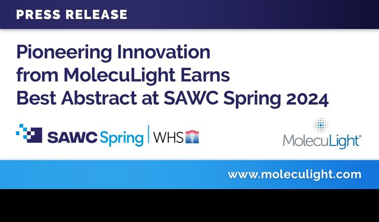 Comunicados Internacional