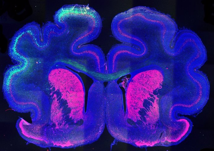 Imagen Del Cerebro De Un Hurón Que Muestra El Patrón De Plegamiento Alterado (Izquierda) Por La Proteína Cux2.