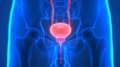 Un tinte brillante ayuda a los cirujanos a erradicar el cáncer de próstata