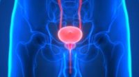 Un tinte brillante ayuda a los cirujanos a erradicar el cáncer de próstata