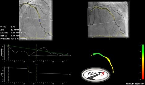 Comunicados Internacional