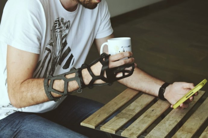 Archivo - Propuesta de material ortopédigo 3D.