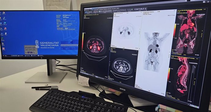 El Hospital Clínico licita la adquisición de diez estaciones de trabajo para la lectura de pruebas radiológicas 