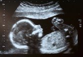 Foto: Hidronefrosis congénita, la anomalía fetal más frecuente: ¿Y si no se detecta a tiempo?