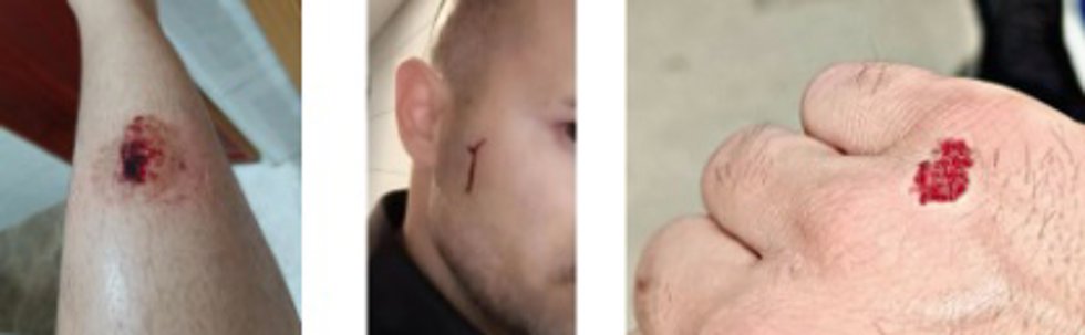 Un hombre agrede a varios policías al fallarles la táser por un fallo electrónico