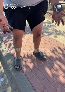 Imagen de la víctima, con la sheridas prvocadas por la agresión