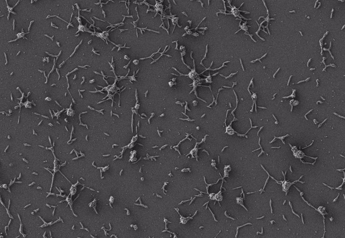 Archivo - Imágenes de células de 'Mycoplasma pneumoniae'.