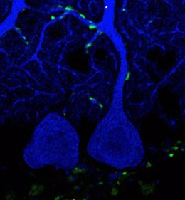 Archivo - Imagen de microscopía con botones sinápticos (verde) de fibras trepadoras sobre una célula de Purkinje (azul) del cerebelo de un ratón, expresando receptores de kainato.