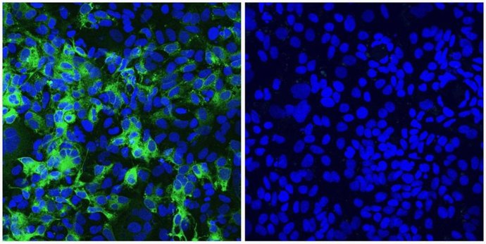 Imagen de las líneas celulares infectadas con el Virus de la hepatitis C marcado en verde (izquierda), y tras la curación de la infección (derecha).